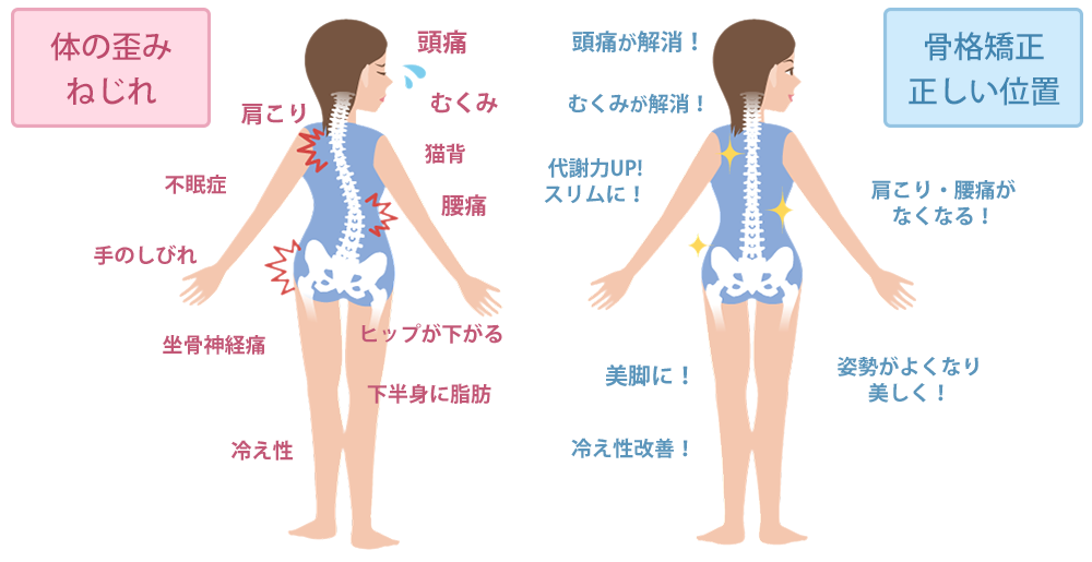 骨格矯正で、頭痛・腰痛などが改善